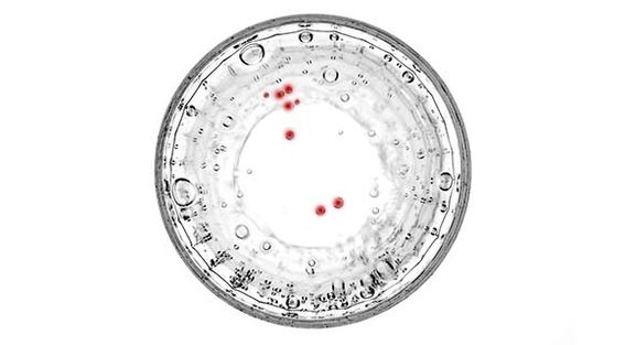 Se hai sintomi di prostatite, dovresti sottoporti a test per infezioni nascoste.